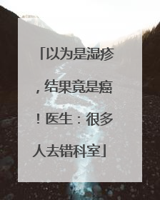 以为是湿疹，结果竟是癌！医生：很多人去错科室